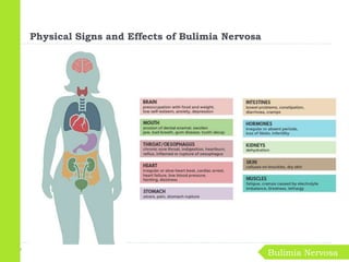 Bulimia Nervosa
Physical Signs and Effects of Bulimia Nervosa
 