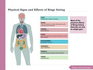 Binge-eating disorder
Physical Signs and Effects of Binge Eating
Most of the
physical effects
of Binge Eating
Disorder are due
to weight gain
 