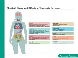 Physical Signs and Effects of Anorexia Nervosa
Anorexia Nervosa
 