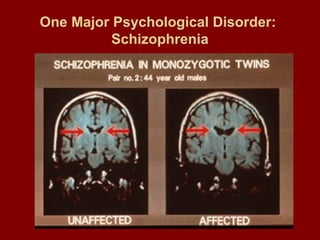 One Major Psychological Disorder: 
Schizophrenia 
 