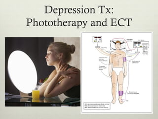 Depression Tx:
Phototherapy and ECT
 