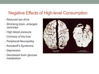 Negative Effects of High-level Consumption
• Reduced sex drive
• Shrinking brain, enlarged
ventricles
• High blood pressure
• Cirrhosis of the liver
• Peripheral Neuropathy
• Korsakoff’s Syndrome
• Depression
• Decreased brain glucose
metabolism
 