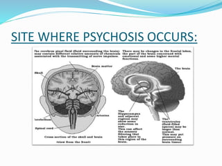 SITE WHERE PSYCHOSIS OCCURS:
 