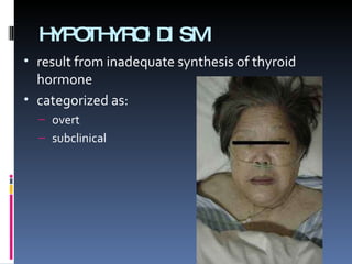 HYPOTHYROIDISM result from inadequate synthesis of thyroid hormone  categorized as: overt  subclinical 