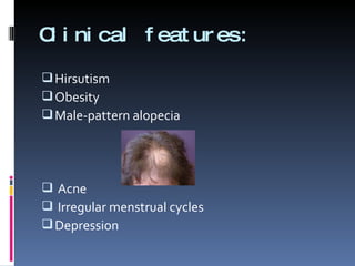 Clinical features: Hirsutism Obesity Male-pattern alopecia Acne Irregular menstrual cycles Depression 