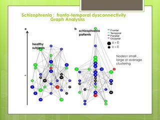 Schizophrenia : fronto-temporal dysconnectivity
            Graph Analysiss

                         schizophrenia
                         patients


    healthy
    subjects

                                          Nodes= small ,
                                          large or average
                                          clustering
 