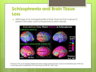 Schizophrenia and Brain Tissue
 Loss
      MRI image of an averaged profile of brain tissue loss from a group of
       patients with early- onset schizophrenia (5 years interval)




Thompson, P.M. et al: Mapping Adolescent brain change reveals dynamic wave of accelerated gray matter loss
in very early-onset schizophrenia. Proc Natl Acad Sci USA 98, 11650-11655
 