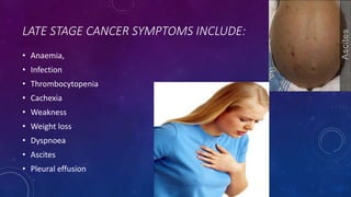 LATE STAGE CANCER SYMPTOMS INCLUDE:
• Anaemia,
• Infection
• Thrombocytopenia
• Cachexia
• Weakness
• Weight loss
• Dyspnoea
• Ascites
• Pleural effusion
 