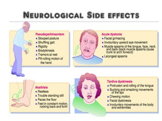 Neurological Side effects
 