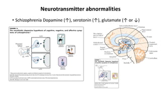 Neurotransmitter abnormalities
• Schizophrenia Dopamine (↑), serotonin (↑), glutamate (↑ or ↓)
 
