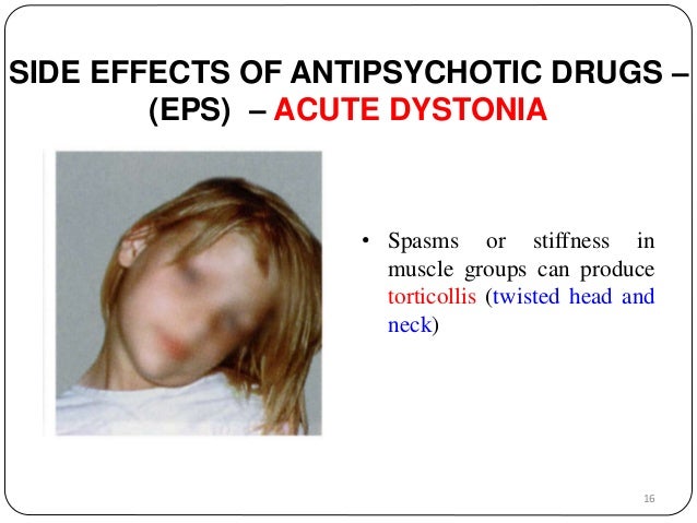 Artane Dosage For Dystonia