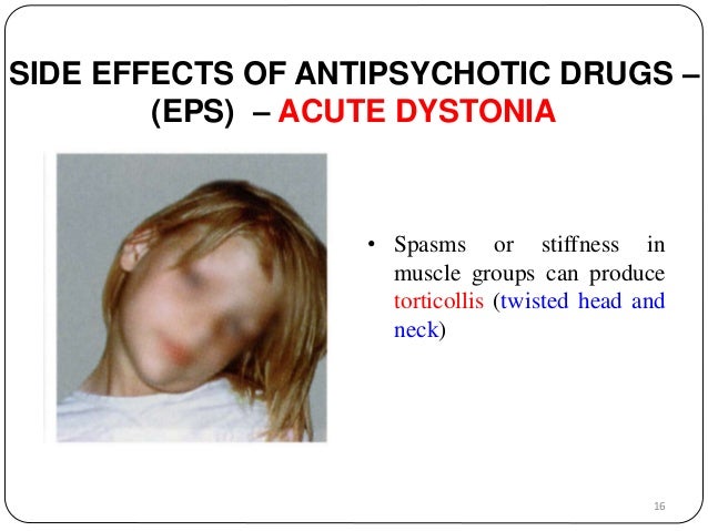 Fluconazole 150mg cost