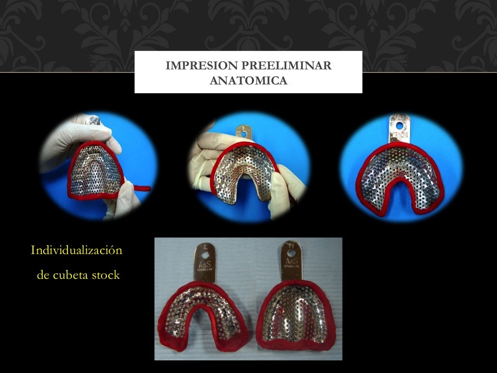 Impresion Definitiva en Protesis Total