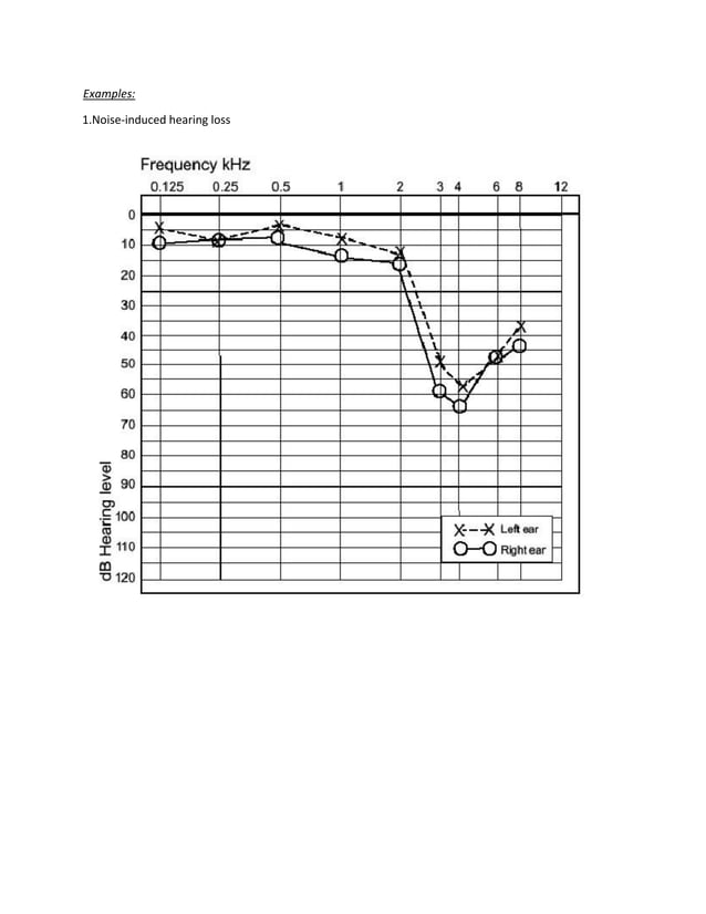 Pure Tone Audiometry | PDF | Digital Audio | Computer Software and ...