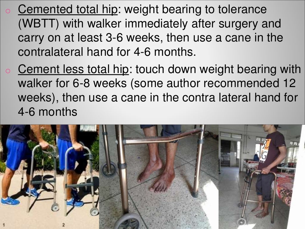 Physiotherapy Rehab After Total Hip Replacement