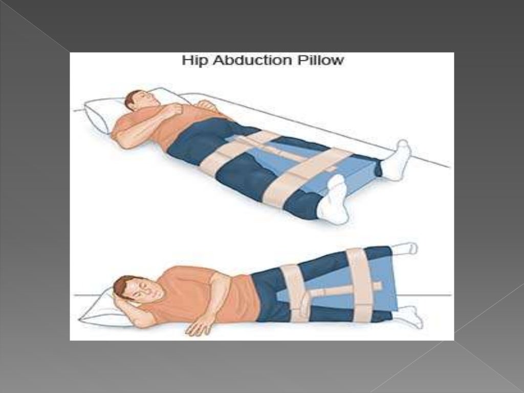 Physiotherapy Rehab After Total Hip Replacement