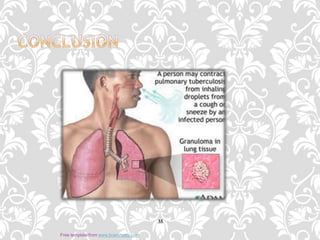 35
Free template from www.brainybetty.com
 