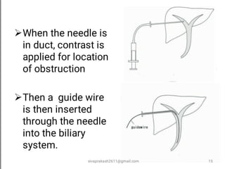 sivaprakash2611@gmail.com 15
 