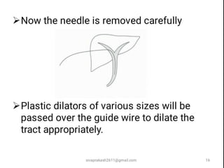 sivaprakash2611@gmail.com 16
 