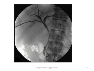 sivaprakash2611@gmail.com 21
 