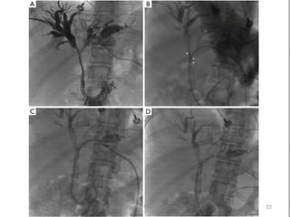 sivaprakash2611@gmail.com 22
 