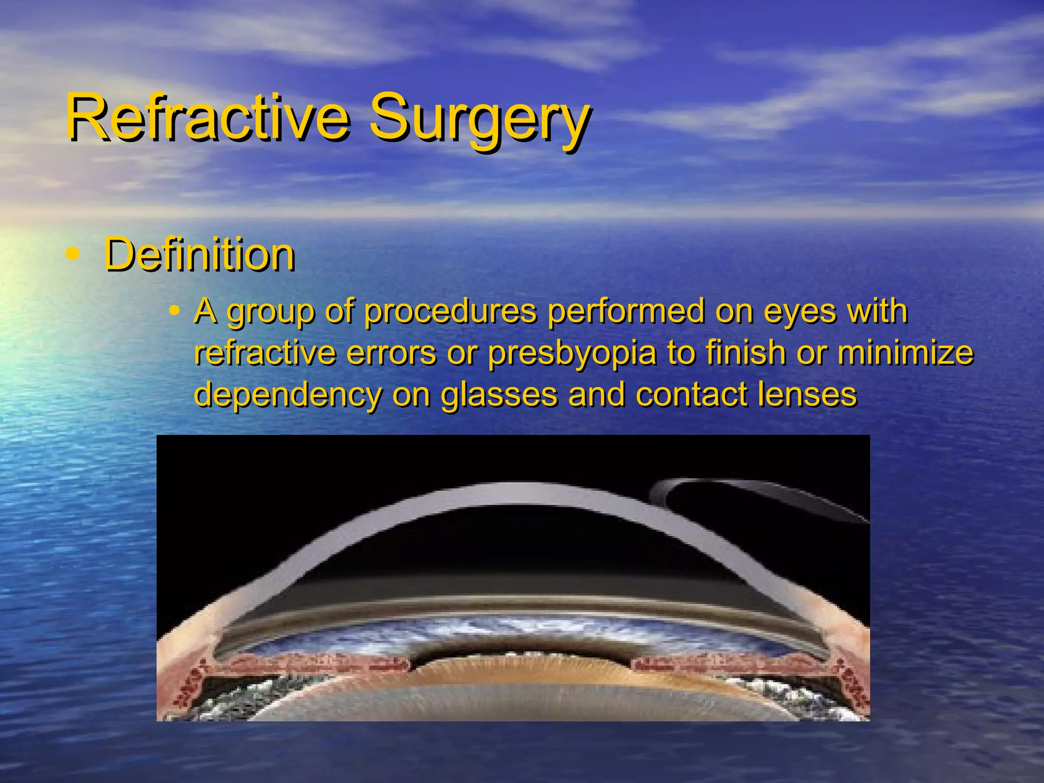 Refractive errors and Refractive Surgery-Basic Concepts | PPT