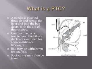 P T C | PPT