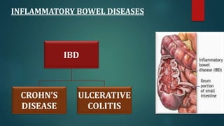 INFLAMMATORY BOWEL DISEASES
IBD
ULCERATIVE
COLITIS
CROHN’S
DISEASE
 