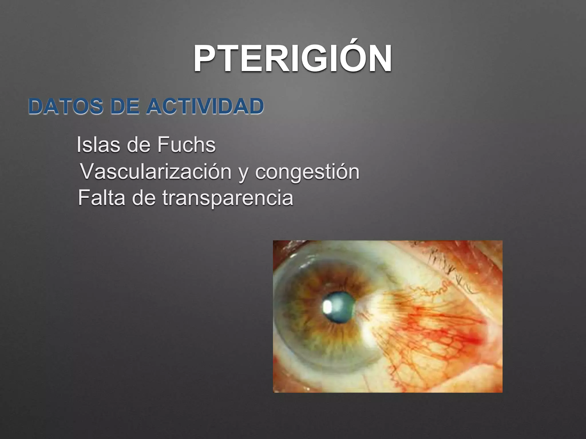 Piterigeno Pterigion | PPTX
