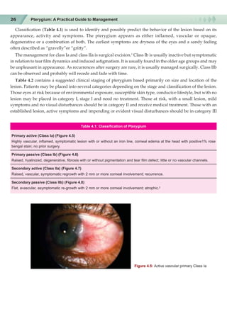Pterygium.pdf