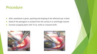 Procedure
 After anesthesia is given, painting and draping of the affected eye is done
 Head of the pterygium is avulsed from the cornea in a centrifugal manner
 Corneal scrapping done with 15 no. knife or crescent knife
 