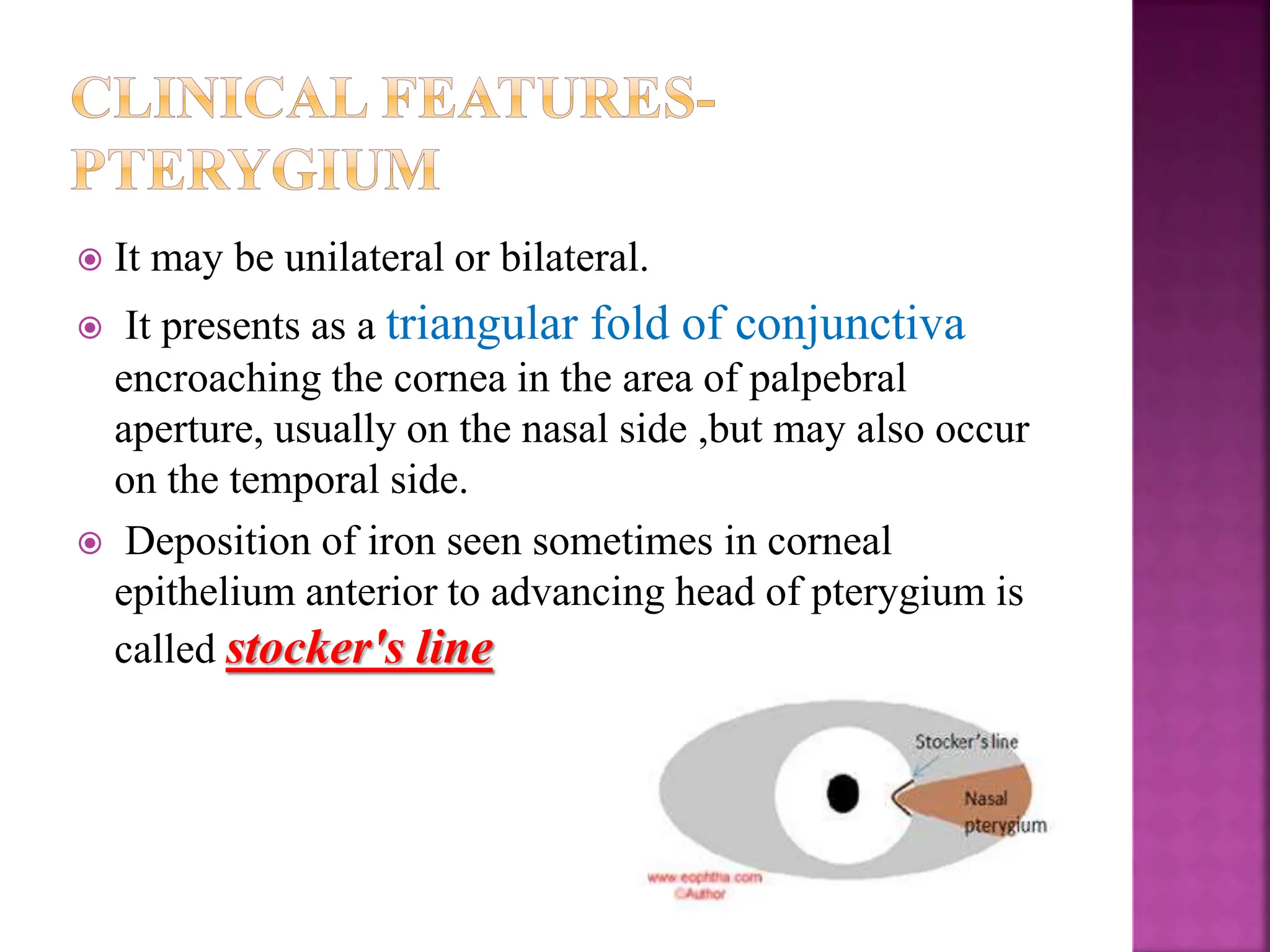PTERYGIUM ,clinical picture and its management.pptx