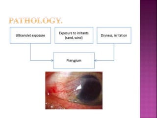 PTERYGIUM ,clinical picture and its management.pptx