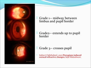 Pterygium Clinical Considerations | PPT