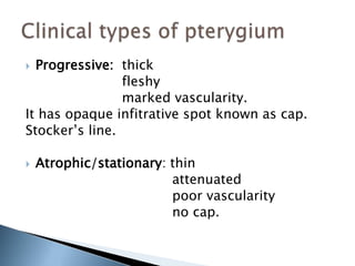  Progressive: thick
fleshy
marked vascularity.
It has opaque infitrative spot known as cap.
Stocker’s line.
 Atrophic/stationary: thin
attenuated
poor vascularity
no cap.
 