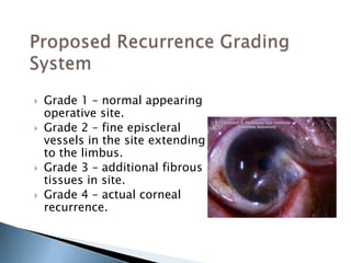  Grade 1 – normal appearing
operative site.
 Grade 2 – fine episcleral
vessels in the site extending
to the limbus.
 Grade 3 – additional fibrous
tissues in site.
 Grade 4 – actual corneal
recurrence.
 