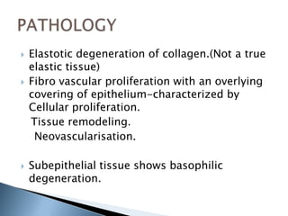    Elastotic degeneration of collagen.(Not a true
    elastic tissue)
   Fibro vascular proliferation with an overlying
    covering of epithelium-characterized by
    Cellular proliferation.
    Tissue remodeling.
     Neovascularisation.

   Subepithelial tissue shows basophilic
    degeneration.
 