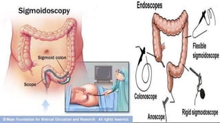 introduction of lower GI disorders | PPTX