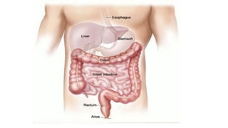 introduction of lower GI disorders | PPTX