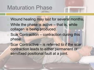 Scar Contraction Pt for Integumentary Conditions | PPTX