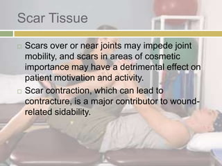 Pt for Integumentary Conditions | PPTX