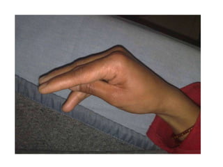 TETANY
+Ca              Excitability
+

+Ca
+              Excitability
 