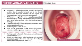 Comprehensive Female Genitalia Pathology: Anatomy, Cases, and Histology ...
