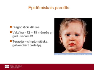 15
 Diagnosticē klīniski
 Vakcīna - 12 – 15 mēnešu un 7
gadu vecumā!!
 Terapija – simptomātiska,
galvenokārt pretsāpju
Epidēmiskais parotīts
 