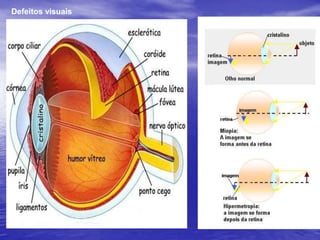 Óptica da visãoDados:Diâmetro: 22 mmEsclerótica: dá estabilidademecânica ao olho.Coróide: irrigação sanguínea do globo ocular.Retina: possui células sensoriais (cones, bastonetes)Nervo óptico: estabelececomunicação com o cérebro.Pupila: orifício de diâmetrovariável que controla a qde de luz que penetra no olho.Cristalino: lente convergentede foco variável .