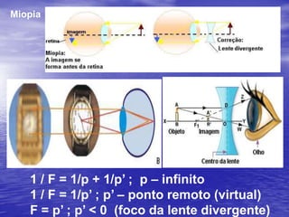 Adaptação visual (músculos da íris e pupila)Muita luz(1,5 – 2,0) mmPouca luz(8,0 – 10,0) mm