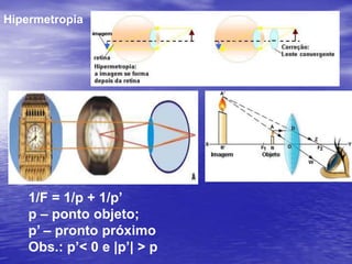 CONCEITOS BÁSICOS (músculos ciliares e cristalino) ACOMODAÇÃO VISUAL é o mecanismo pelo qual o olho humano altera a foco do cristalino, permitindo à pessoa normal enxergar nitidamente desde uma distância de aproximadamente 25 cm até o infinito.PONTO PRÓXIMO ( PP ) de um globo ocular é a posição mais próxima que pode ser vista nitidamente, realizando esforço máximo de acomodação. Na pessoa normal, situa-se, convencionalmente, a 25 cm. Nessa situação os músculos ciliares mostram-se contraídos e o cristalino assume a mínima distância focal.PONTO REMOTO ( PR ) de um globo ocular é a posição mais afastada que pode ser vista nitidamente, sem esforço de acomodação. Na pessoa normal, este ponto está situado no infinito. Nessa situação os músculos ciliares mostram-se relaxados e o cristalino assume a máxima distância focal. 