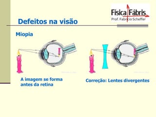 Defeitos na visão
Miopia

A imagem se forma
antes da retina

Correção: Lentes divergentes

 