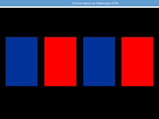XI Curso Básico de Oftalmologia HCPA
 