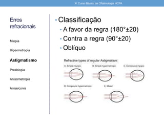 Erros
refracionais
• Classificação
• A favor da regra (180°±20)
• Contra a regra (90°±20)
• Oblíquo
Miopia
Hipermetropia
Astigmatismo
Presbiopia
Anisometropia
Aniseiconia
XI Curso Básico de Oftalmologia HCPA
 